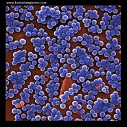 mrsa electron microscopy